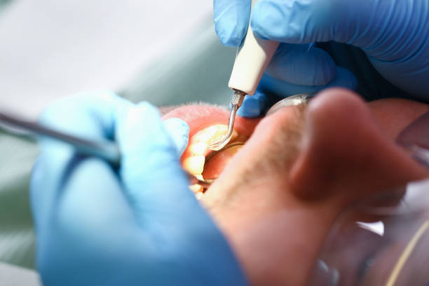 Best Emergency TMJ Treatment in Hillsboro, MO