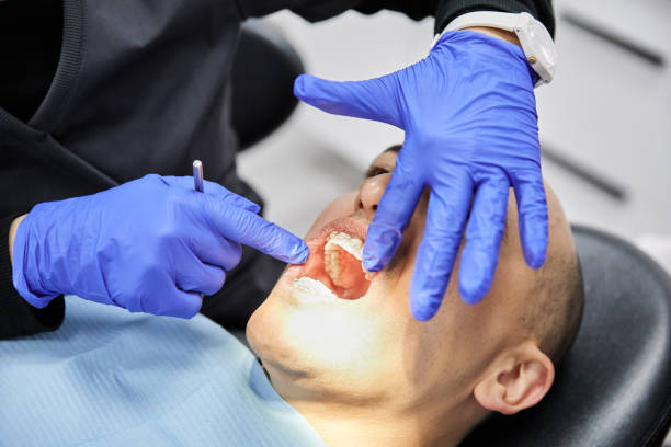 Best After-Hours Dental Trauma Care in Hillsboro, MO